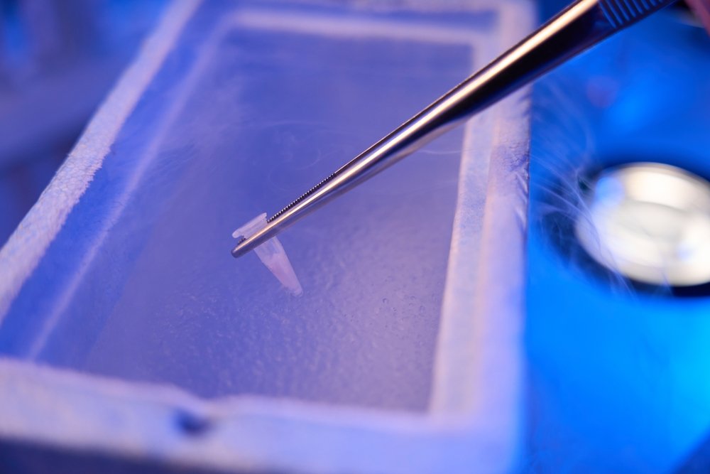 Laboratorio di embriologia con contenitore in azoto liquido per la vitrificazione e crioconservazione degli ovociti
