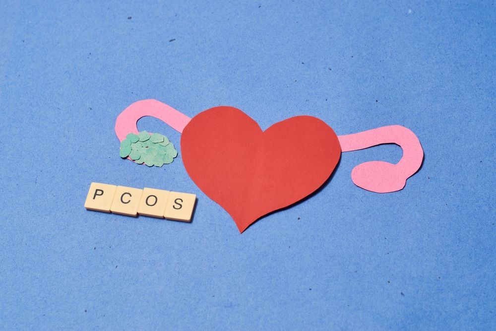 pcos ovaio policistico e fertilità