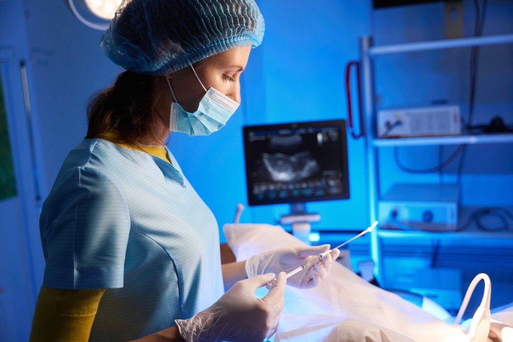 Medico che esegue un'ecografia transvaginale durante il monitoraggio della stimolazione ovarica in un percorso di PMA