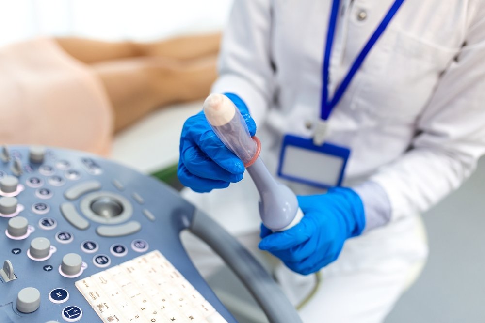 Ginecologo che esegue un trasferimento embrionale con catetere e guida ecografica in sala ambulatoriale